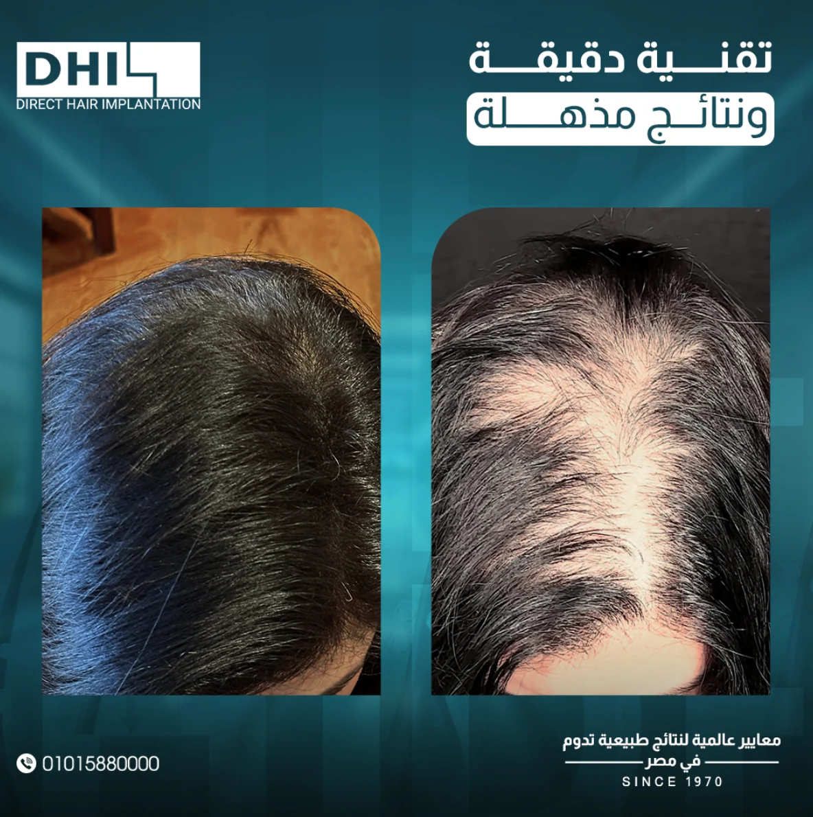 Hair treatment result campaign created for DHI Egypt